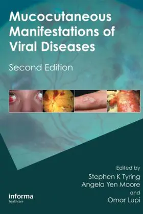 Tyring / Yen Moore / Lupi |  Mucocutaneous Manifestations of Viral Diseases | Buch |  Sack Fachmedien