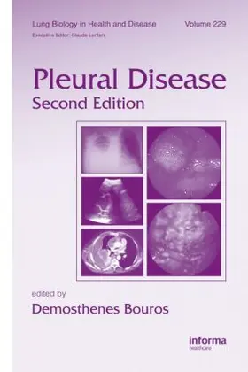 Bouros |  Pleural Disease | Buch |  Sack Fachmedien