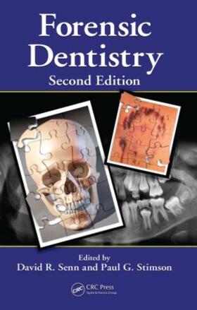 Senn / Stimson |  Forensic Dentistry | Buch |  Sack Fachmedien