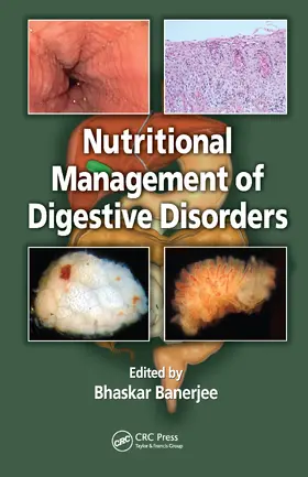 Banerjee |  Nutritional Management of Digestive Disorders | Buch |  Sack Fachmedien