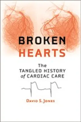 Jones |  Broken Hearts | eBook | Sack Fachmedien