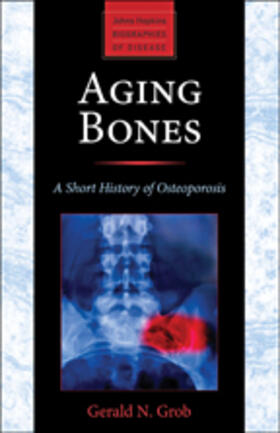 Grob |  Aging Bones | Buch |  Sack Fachmedien