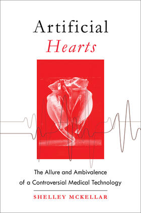 McKellar |  Artificial Hearts | Buch |  Sack Fachmedien