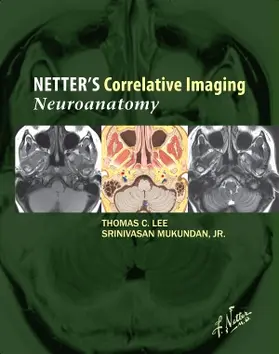 Lee / Mukundan |  Netter's Correlative Imaging: Neuroanatomy with Access Code | Buch |  Sack Fachmedien