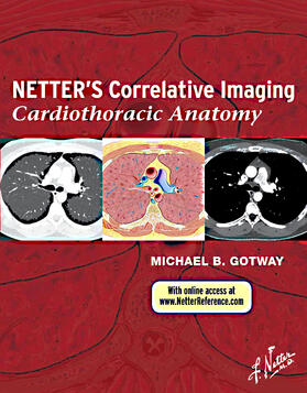 Gotway |  Netter's Correlative Imaging: Cardiothoracic Anatomy | Buch |  Sack Fachmedien