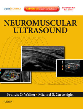 Walker / Cartwright |  Neuromuscular Ultrasound | Buch |  Sack Fachmedien