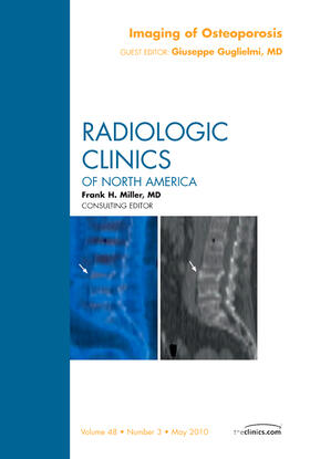 Guglielmi |  Imaging of Osteoporosis, an Issue of Radiologic Clinics of North America | Buch |  Sack Fachmedien
