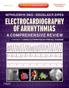 Das / Zipes |  Electrocardiography of Arrhythmias: A Comprehensive Review: A Companion to Cardiac Electrophysiology | Buch |  Sack Fachmedien