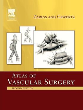Zarins / Gewertz |  Atlas Of Vascular Surgery - Paperback Edition | Buch |  Sack Fachmedien