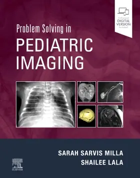 Sarvis Milla / Lala |  Problem Solving in Pediatric Imaging | Buch |  Sack Fachmedien