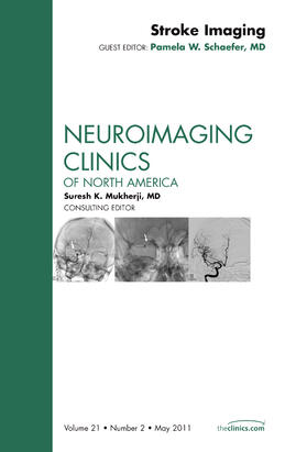 Schaefer |  Stroke Imaging, an Issue of Neuroimaging Clinics | Buch |  Sack Fachmedien