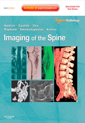 Castillo / Cha / Raybaud |  Imaging of the Spine E-Book | eBook | Sack Fachmedien