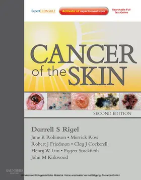 Rigel / Friedman / Robinson |  Cancer of the Skin E-Book | eBook | Sack Fachmedien