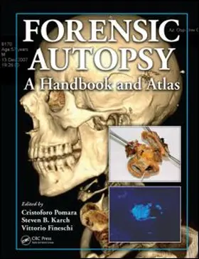 Pomara / Fineschi / Karch |  Forensic Autopsy | Buch |  Sack Fachmedien