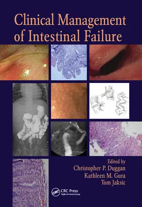 Duggan / Gura / Jaksic |  Clinical Management of Intestinal Failure | Buch |  Sack Fachmedien