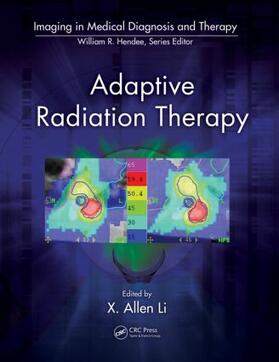 Li |  Adaptive Radiation Therapy | Buch |  Sack Fachmedien