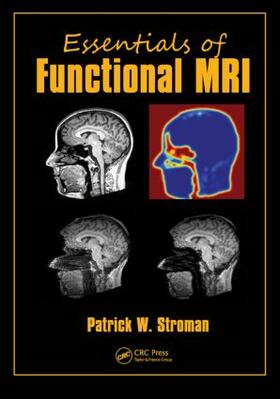 Stroman |  Essentials of Functional MRI | Buch |  Sack Fachmedien
