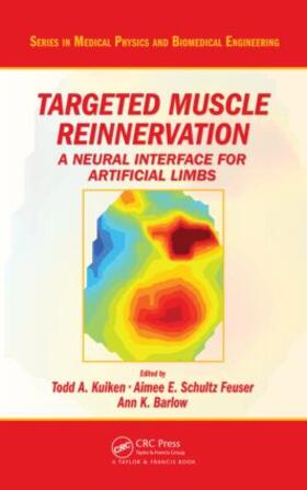 Kuiken / Schultz Feuser / Barlow |  Targeted Muscle Reinnervation | Buch |  Sack Fachmedien