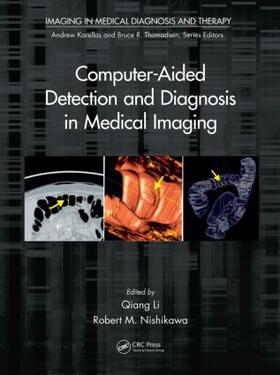 Li / Nishikawa | Computer-Aided Detection and Diagnosis in Medical Imaging | Buch | 978-1-4398-7176-8 | sack.de