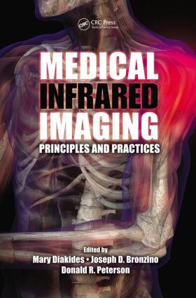 Diakides / Bronzino / Peterson |  Medical Infrared Imaging | Buch |  Sack Fachmedien