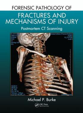 Burke | Forensic Pathology of Fractures and Mechanisms of Injury | Buch | 978-1-4398-8148-4 | sack.de