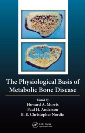 Nordin / Morris / Anderson |  The Physiological Basis of Metabolic Bone Disease | Buch |  Sack Fachmedien