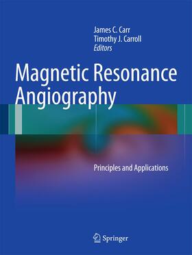 Carroll / Carr |  Magnetic Resonance Angiography | Buch |  Sack Fachmedien