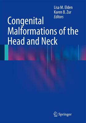 Zur / Elden |  Congenital Malformations of the Head and Neck | Buch |  Sack Fachmedien