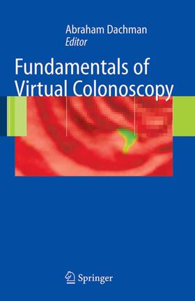 Dachman |  Fundamentals of Virtual Colonoscopy | Buch |  Sack Fachmedien