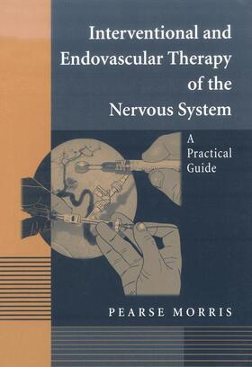 Morris |  Interventional and Endovascular Therapy of the Nervous System | Buch |  Sack Fachmedien