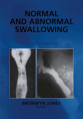 Jones |  Normal and Abnormal Swallowing | Buch |  Sack Fachmedien