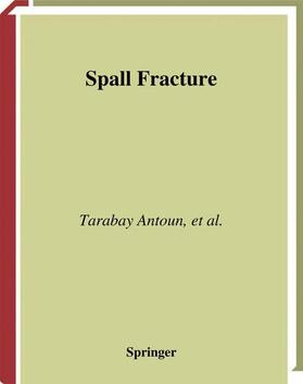 Antoun / Seaman / Utkin |  Spall Fracture | Buch |  Sack Fachmedien
