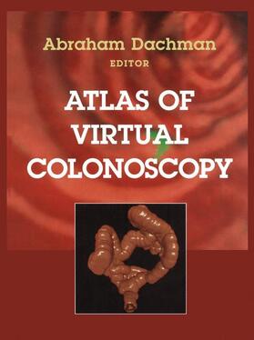 Dachman |  Atlas of Virtual Colonoscopy | Buch |  Sack Fachmedien