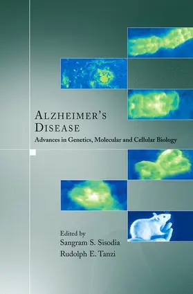 Tanzi / Sisodia |  Alzheimer's Disease | Buch |  Sack Fachmedien