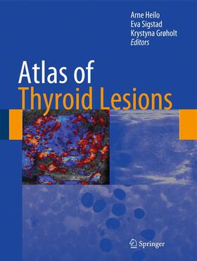 Heilo / Sigstad / Grøholt |  Atlas of Thyroid Lesions | Buch |  Sack Fachmedien