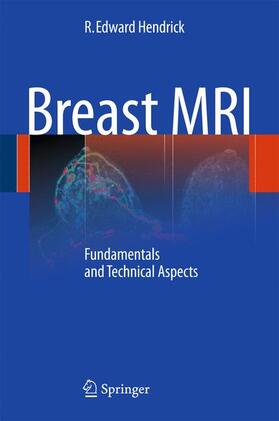 Hendrick |  Breast MRI | Buch |  Sack Fachmedien