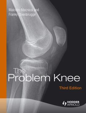 Macnicol / MacNicol / Steenbrugge |  The Problem Knee | Buch |  Sack Fachmedien