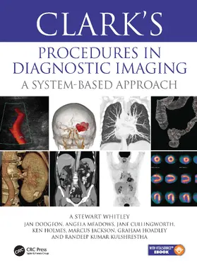 Whitley / Meadows / Dodgeon |  Clark's Procedures in Diagnostic Imaging | Buch |  Sack Fachmedien