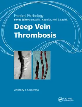 Comerota |  Deep Vein Thrombosis | Buch |  Sack Fachmedien