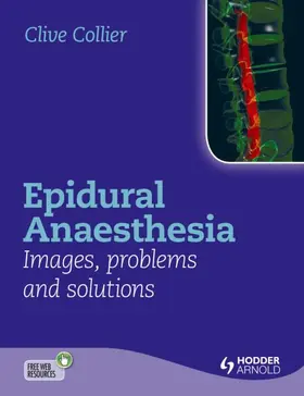 Collier |  Epidural Anaesthesia: Images, Problems and Solutions | Buch |  Sack Fachmedien