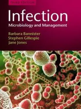 Bannister / Gillespie / Jones |  Infection | eBook | Sack Fachmedien