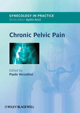 Vercellini |  Chronic Pelvic Pain | Buch |  Sack Fachmedien