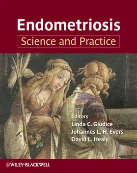 Giudice / Evers / Healy |  Endometriosis | Buch |  Sack Fachmedien