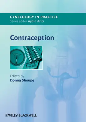 Shoupe |  Contraception | Buch |  Sack Fachmedien