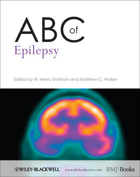 Smithson / Walker |  ABC of Epilepsy | Buch |  Sack Fachmedien