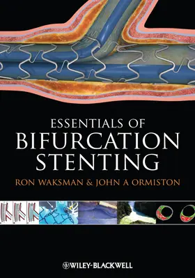 Waksman / Ormiston |  Bifurcation Stenting | Buch |  Sack Fachmedien