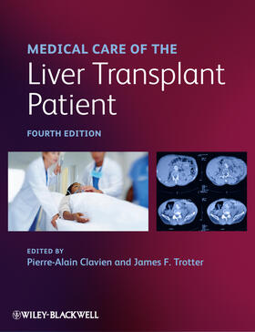Clavien / Trotter |  Medical Care of the Liver Transplant Patient | Buch |  Sack Fachmedien