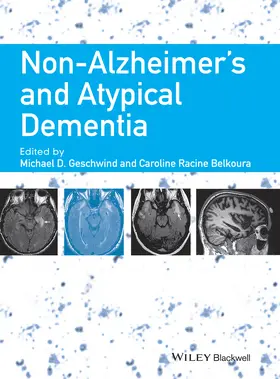 Geschwind / Belkoura |  Non-Alzheimer's and Atypical Dementia | Buch |  Sack Fachmedien