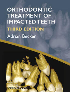 Becker |  Becker: Orthodontic Treatment of Impac | Buch |  Sack Fachmedien