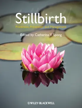 Spong |  Stillbirth | Buch |  Sack Fachmedien